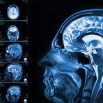 Brain MRI